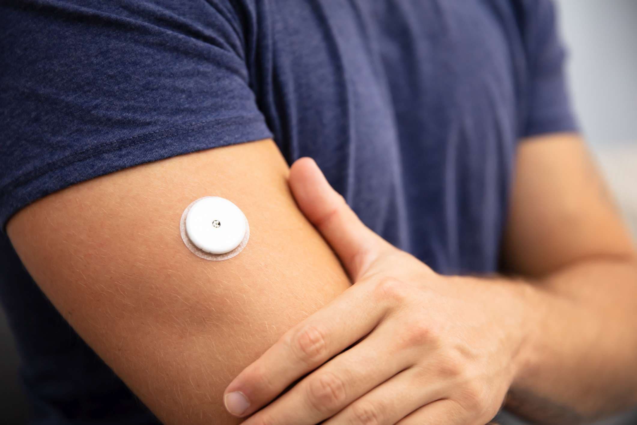Nahaufnahme eines Mannes, der den Glukosespiegel mit einem kontinuierlichen Glukosemonitor auf seinem Arm testet