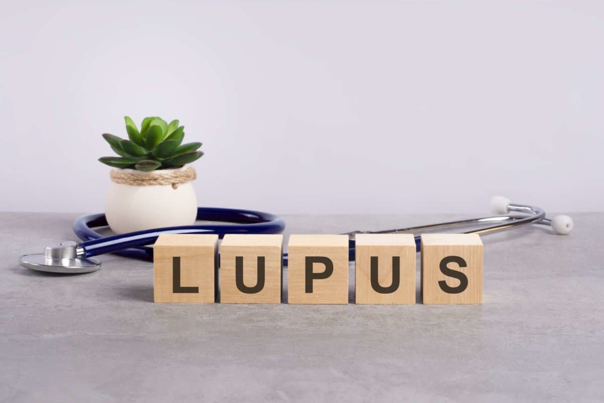 Lupus-Wort auf Holzklötzen und Stethoskop auf hellgrauem Hintergrund geschrieben