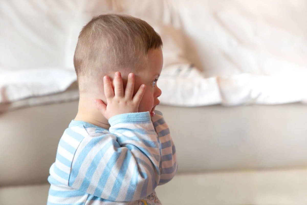 Cute baby boy with Down syndrome closed his ears, deafness