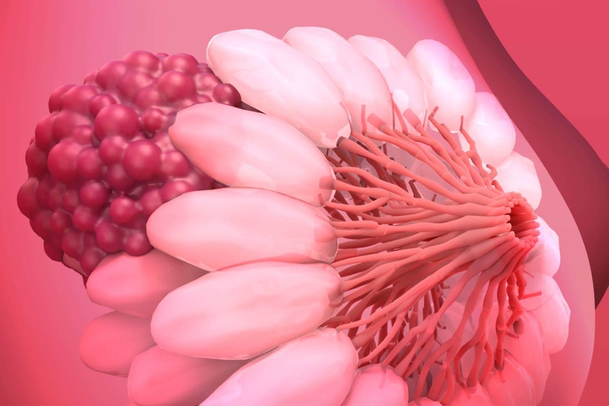 Breast Cancer, Breast anatomy, Growing tumor. Cancer that forms in the cells of the breasts.