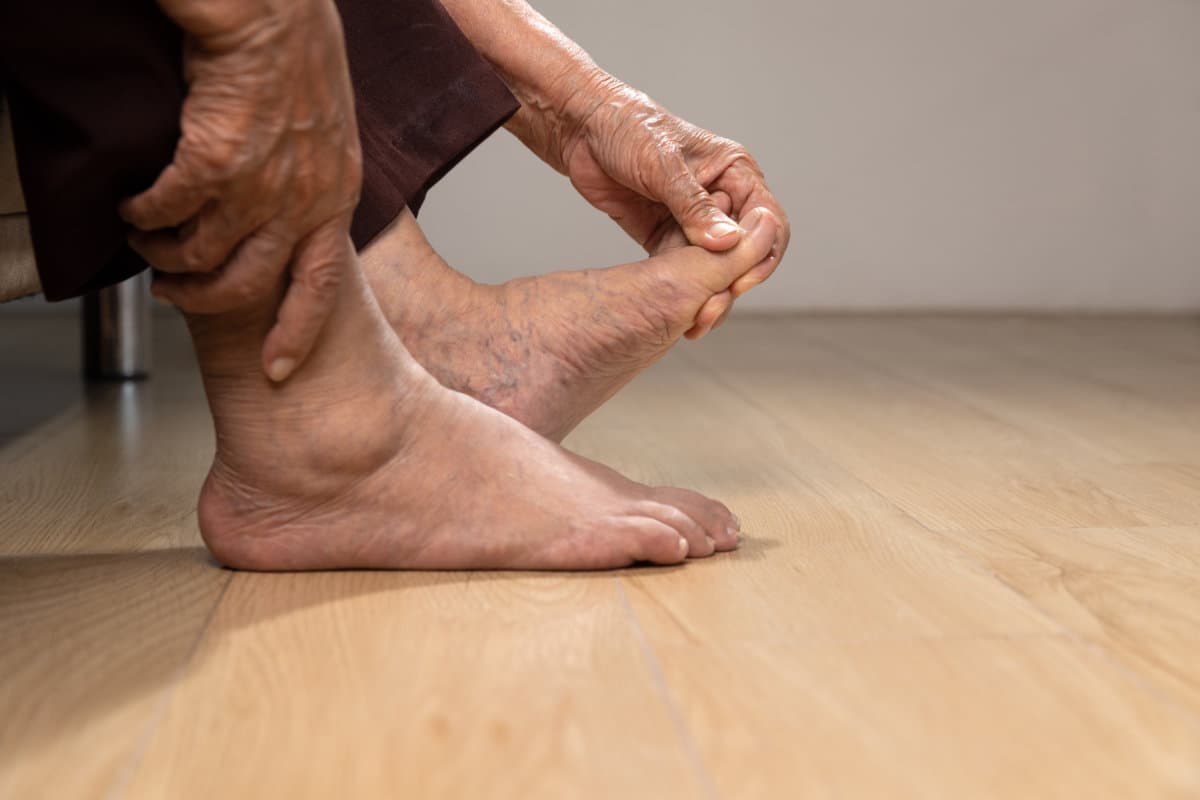 Senior woman massage foot with painful swollen gout inflammation