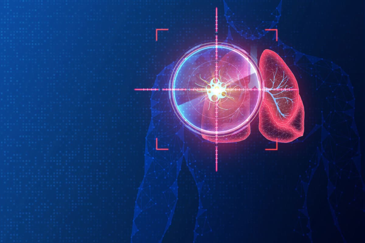 Precision Oncology and Targeted Oncology Therapy &#8211; Conceptual Il