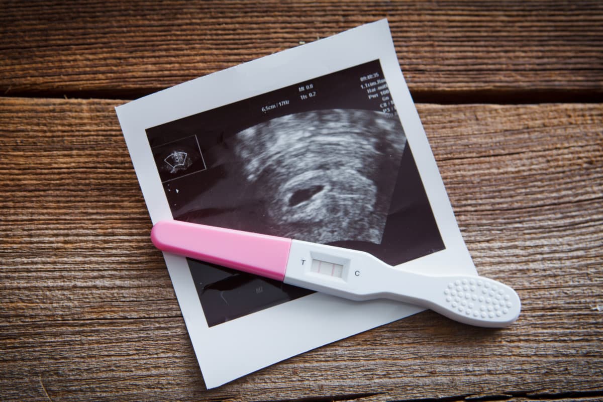 positive pregnany test and a sonogram