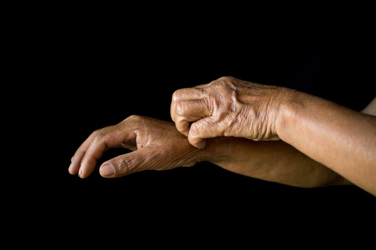 Old hands itching on black background, dermatitis concept