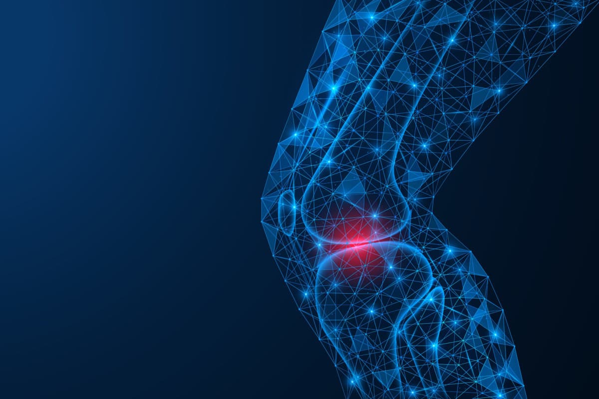 Pain in the knee joint. A polygonal model of lines and points. B