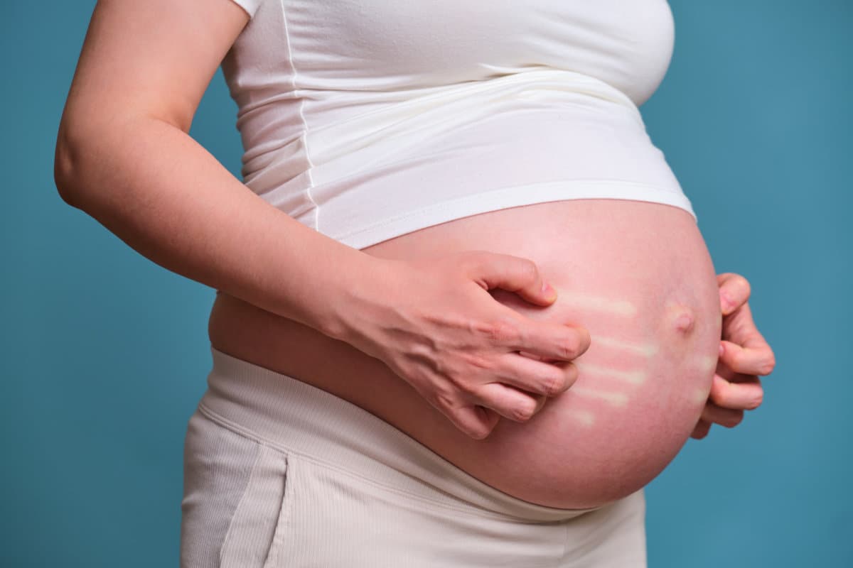 Hands of a pregnant woman scratching her stomach, blue background