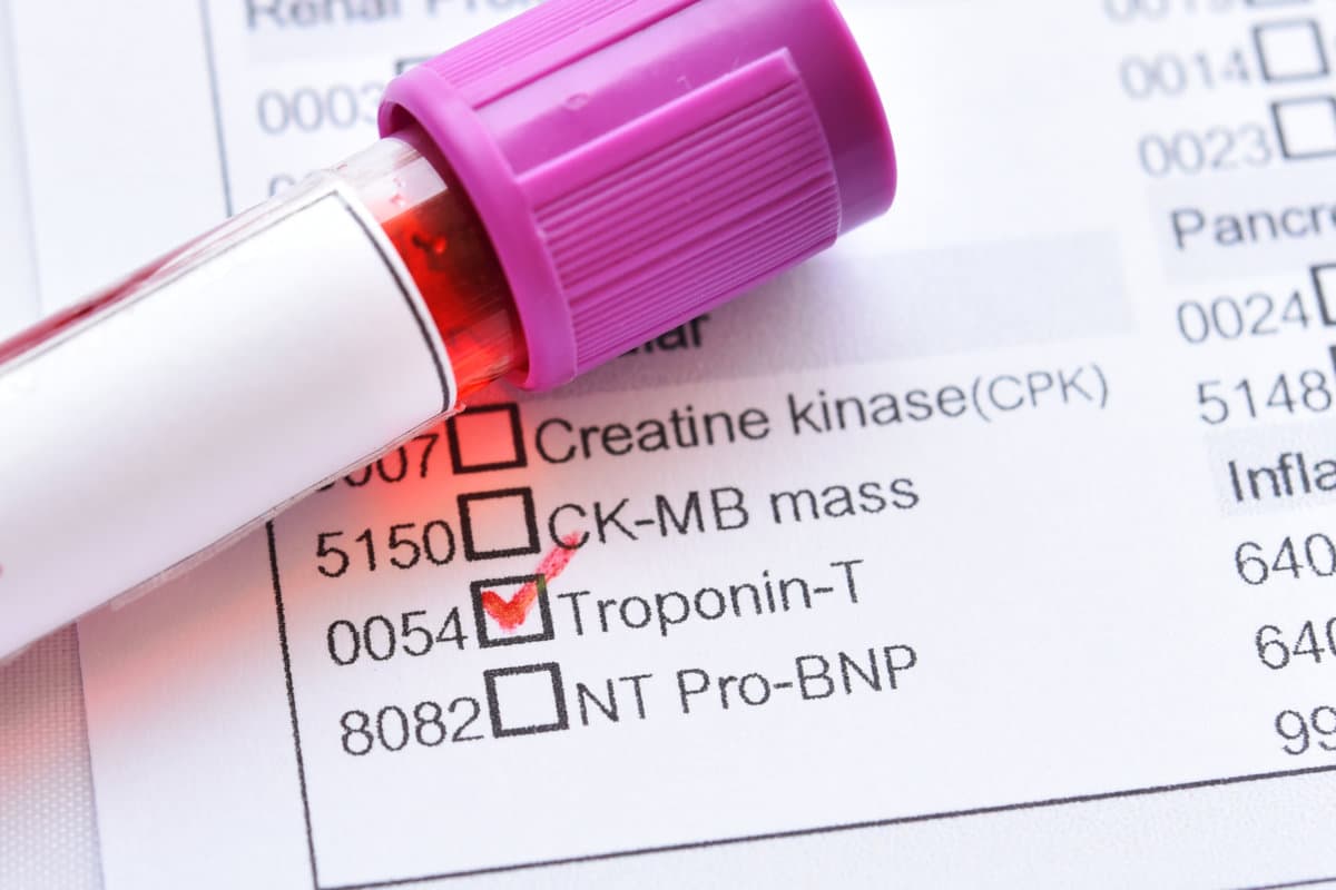 Blood sample tube with laboratory requisition form for Troponin-T test, diagnosis for acute myocardial infarction (AMI)