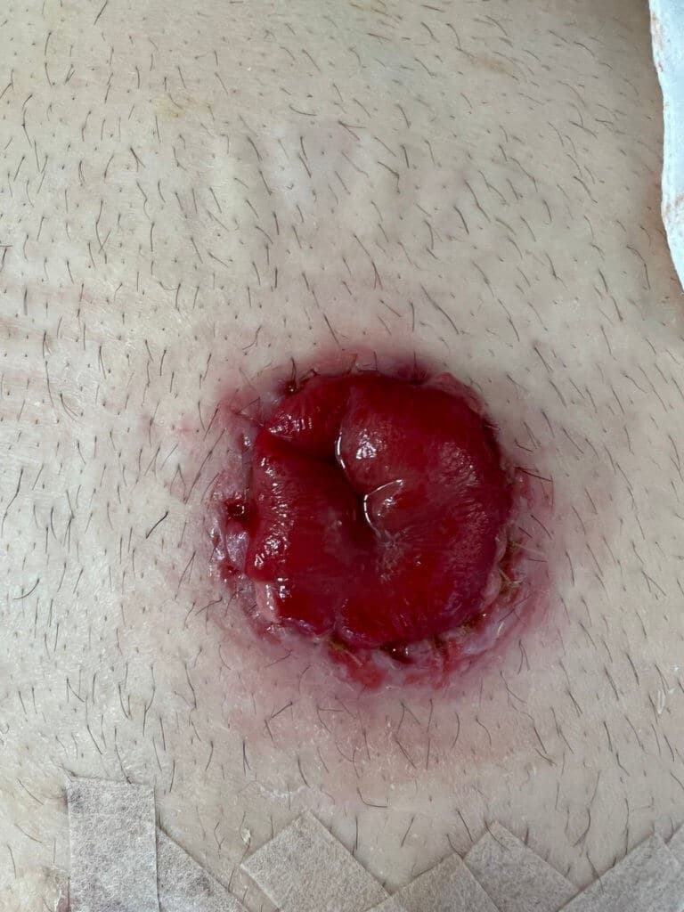 2024-02-05_c-Lemmerer_Foto-Stoma