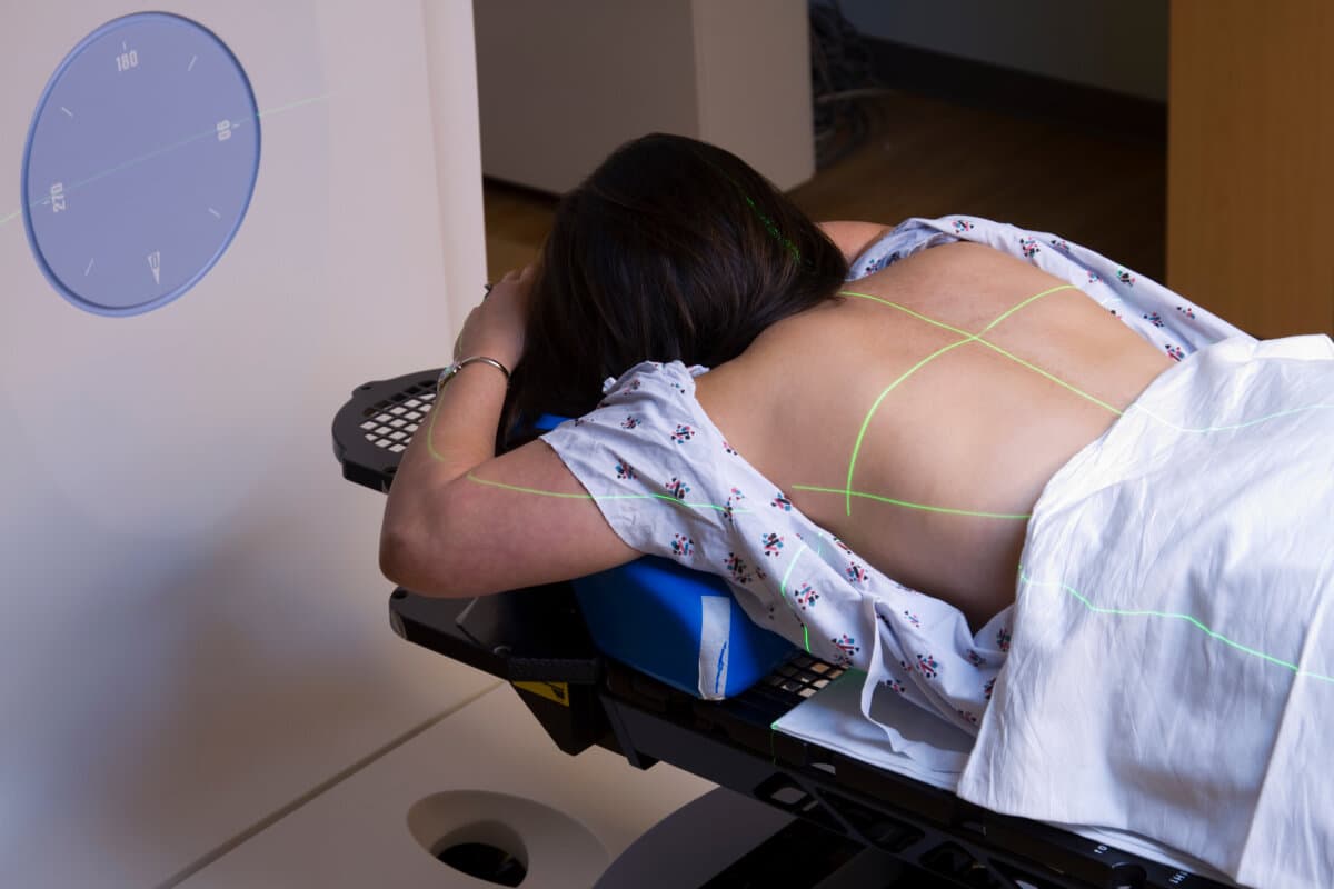 Woman Receiving Radiation Therapy Treatments for Lung Cancer