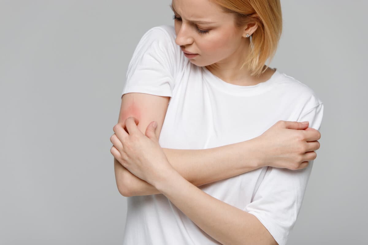 Close up of young woman scratching the itch on her hand, isolated on grey background. Dry skin, animal/food allergy, dermatitis, insect bites, irritation concept.