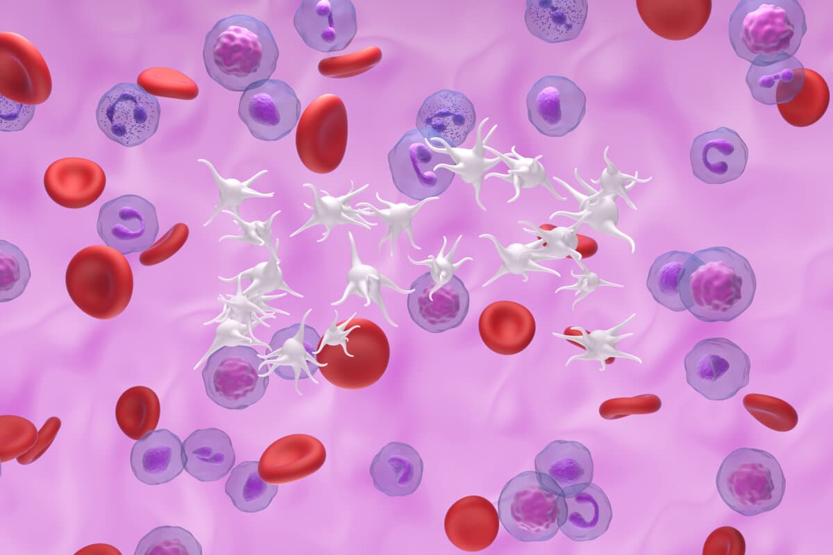 Essential thrombocythemia (ET), a blood cancer by the overproduc