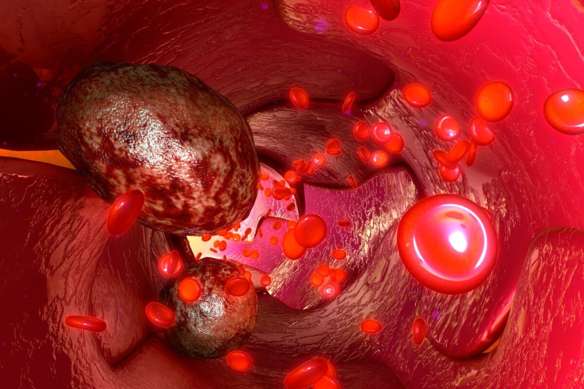 Tumour cells in blood vessels
