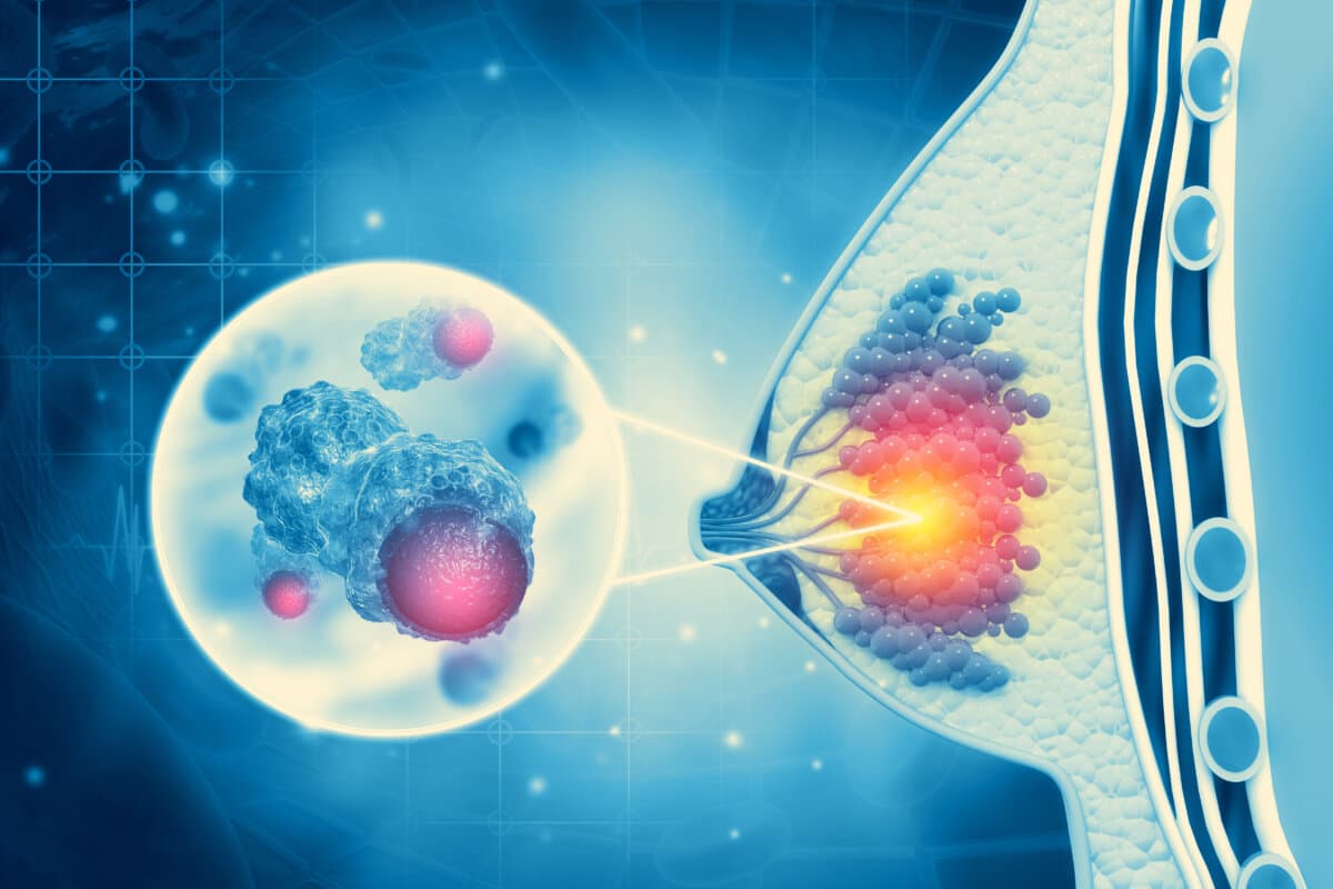 Brustkrebs. Anatomie der weiblichen Brust. 3D-Abbildung