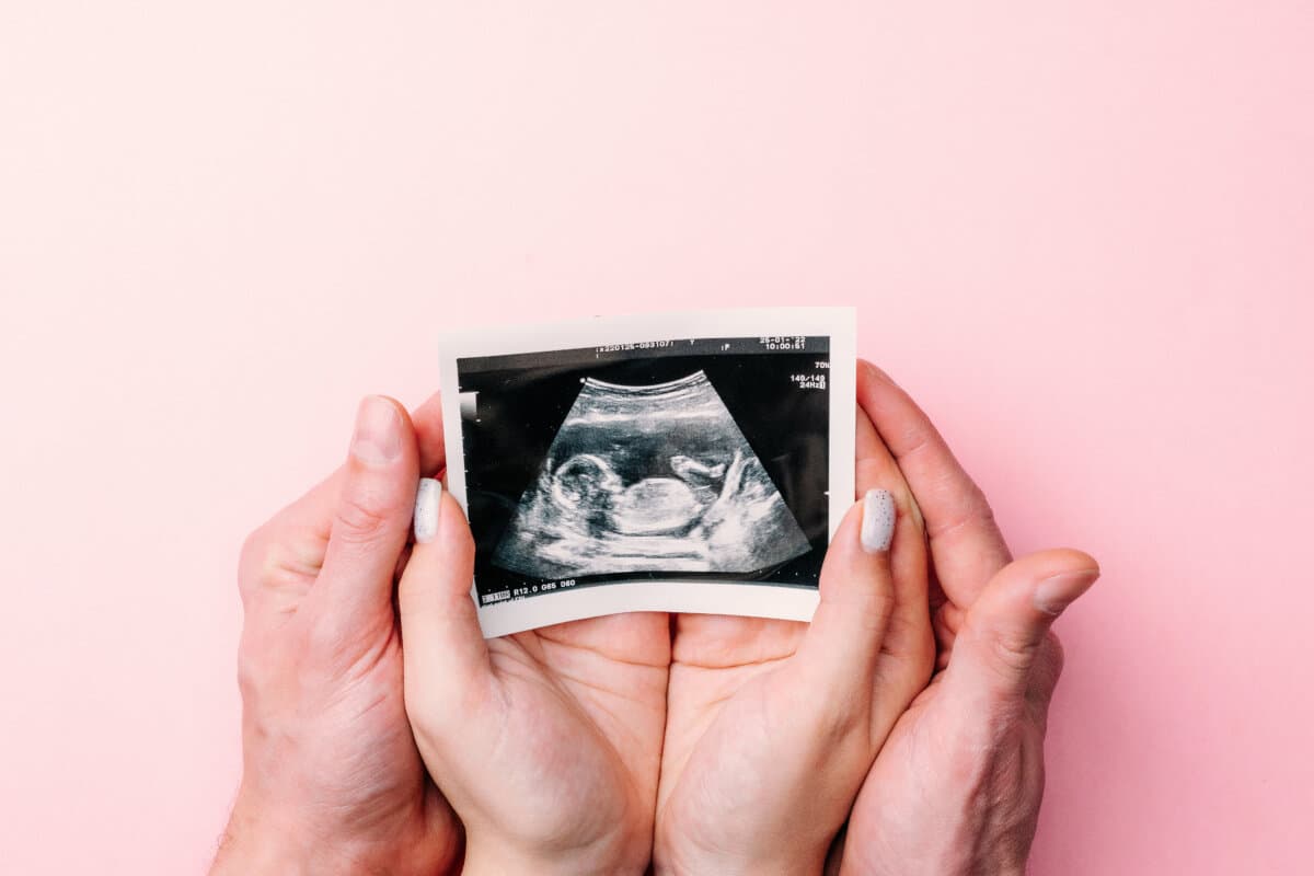 Ultraschallbild eines schwangeren Babys. Frauenhände halten Ultraschallbild der Schwangerschaft auf rosa Hintergrund.