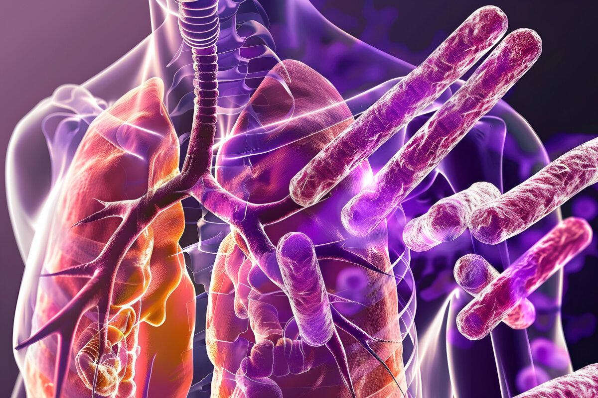 Sekundäre Tuberkulose in der Lunge und Nahaufnahme des Bakteriums Mycobacterium tuberculosis, 3D-Illustration