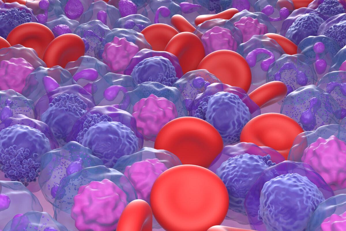 Chronisch myeloische Leukämiezellen, mikroskopische Ansicht, Illustration