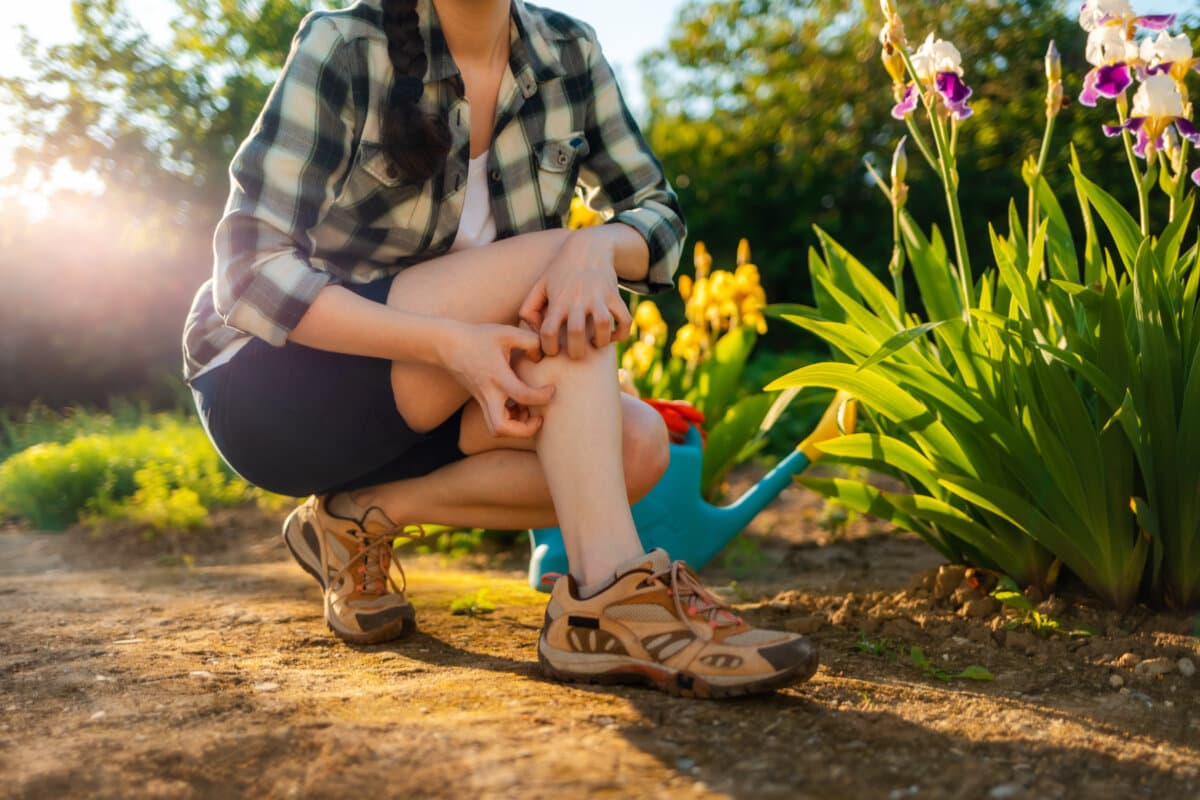 Sommersaison. Frau kratzt sich am Bein, das von einem Mückenstich juckt. Nahaufnahme der Beine. Draußen.