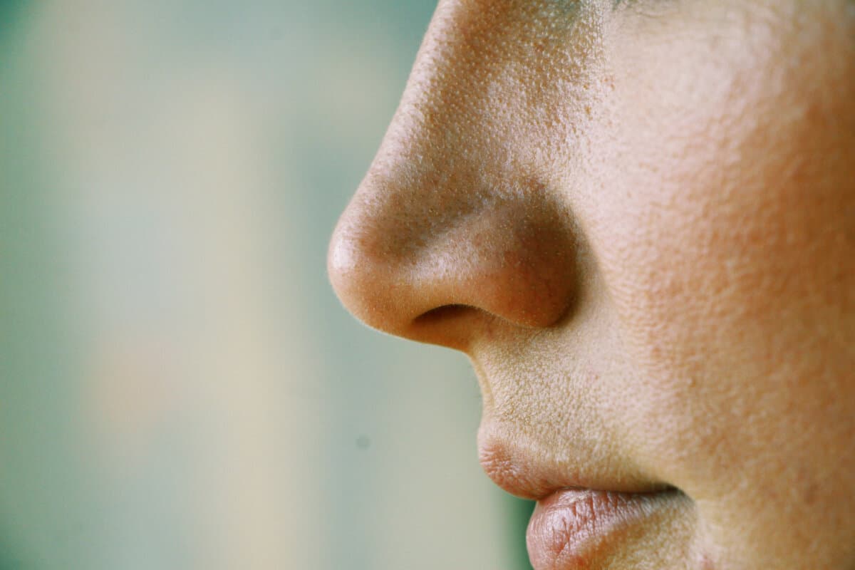 enlarged pores on the girl&#8217;s face close up