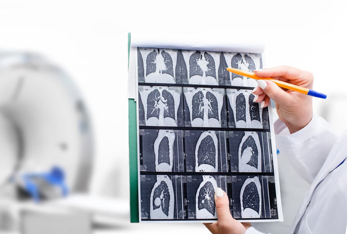 Radiologe zeigt Tomographie-Scan der Lunge eines Patienten über einem CT-Gerät.