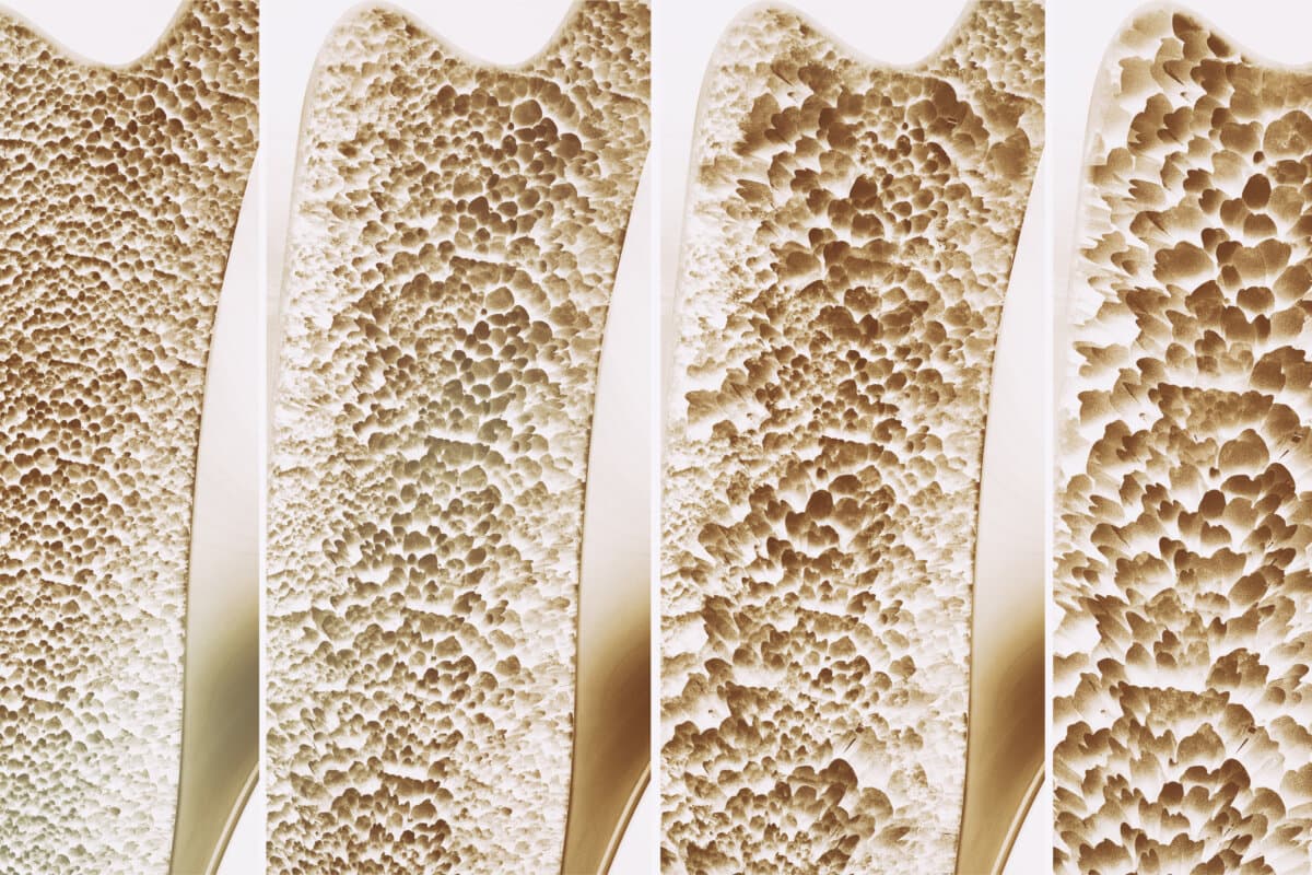 Knochengesunde Ernährung in den Wechseljahren senkt das Osteoporose-Risiko.