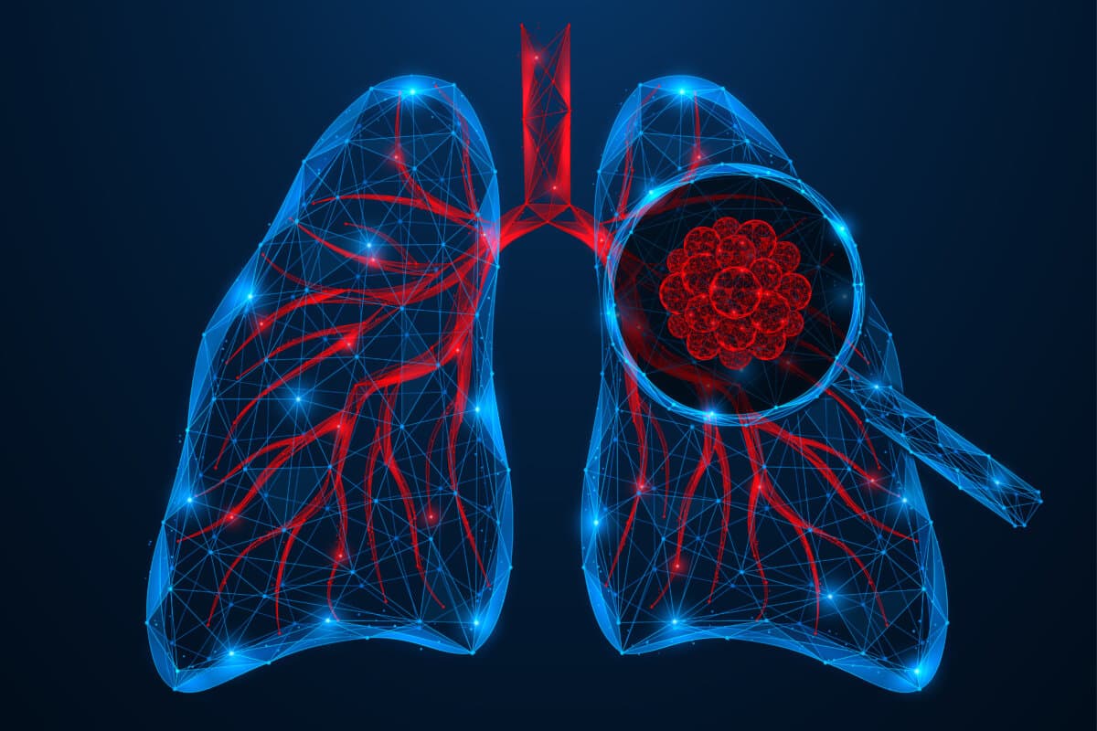 Forschung zu NSCLC