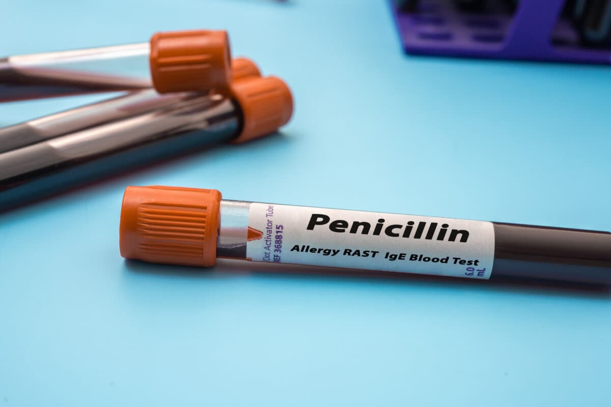 Penicillin-Allergie-RAST-IgE-Bluttests. Reagenzglas auf Blau