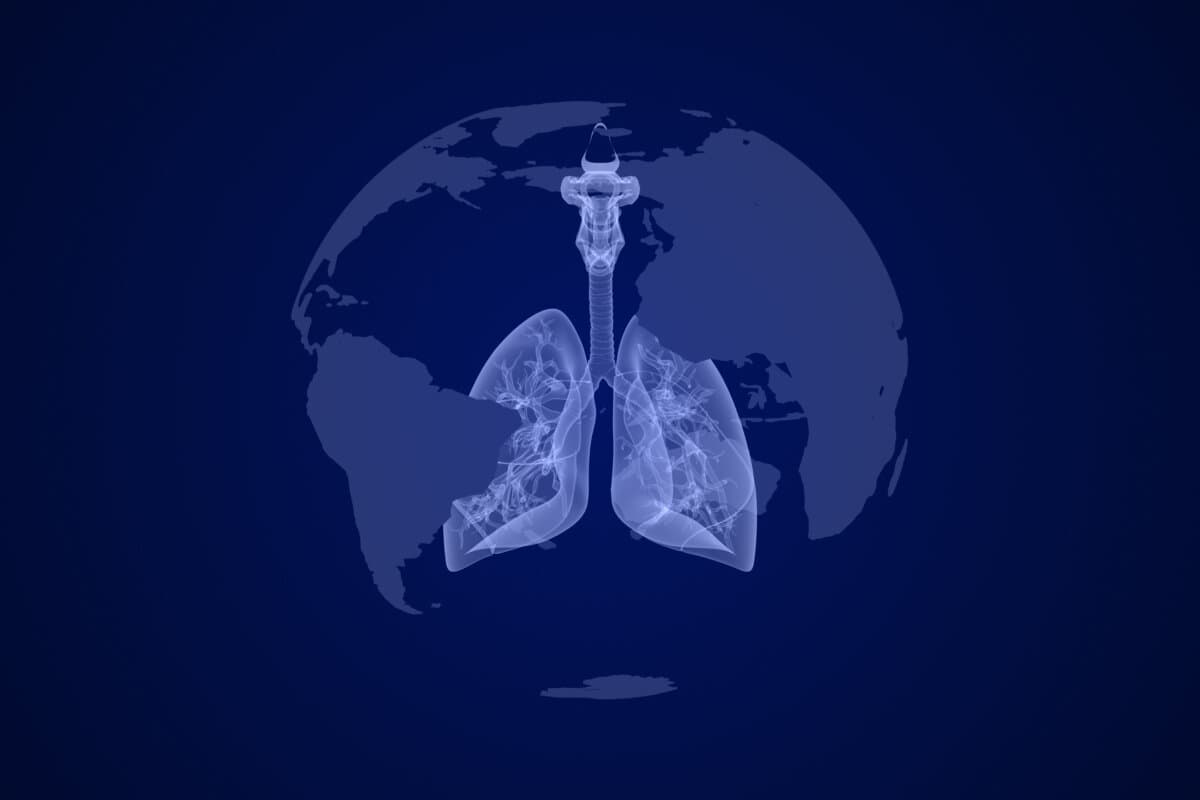 COPD im internationalen Vergleich