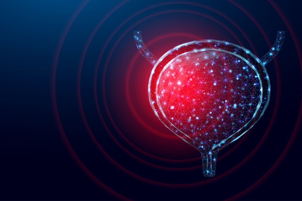 Blasenkrebs: EV+P setzt neue Maßstäbe