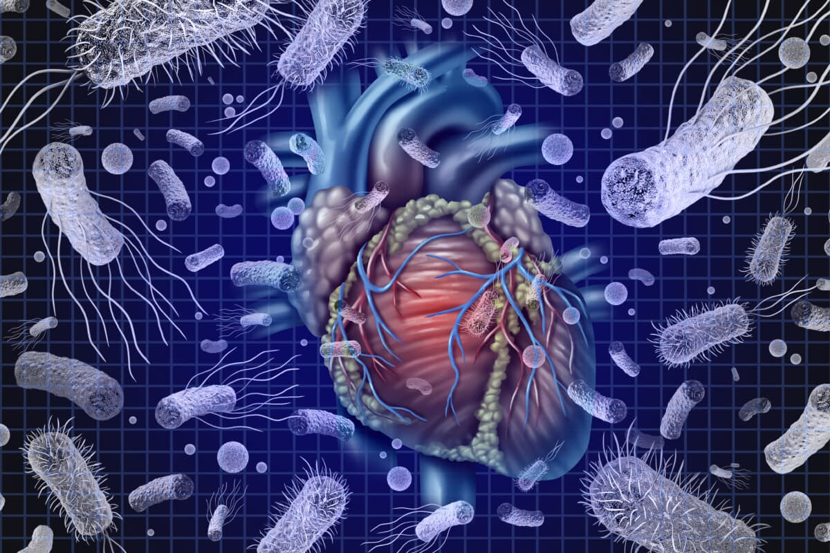 Bakterielle Endokarditis oder Herz- und Bakterieninfektion und Septikämie oder Sepsis als Blutvergiftung durch Keime.