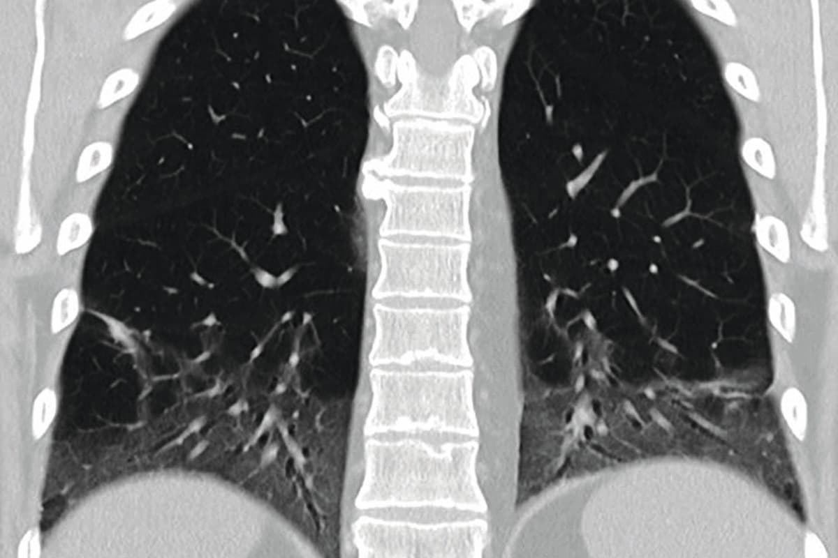 MO_AT_2025_KW45_ccpNL_Abb-1-DIP-2025-10-28