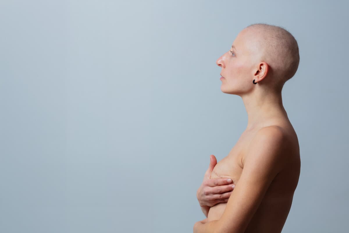 A profile view of a woman, a shaved head, hold her chest with mastectomy scar on a solid-color background