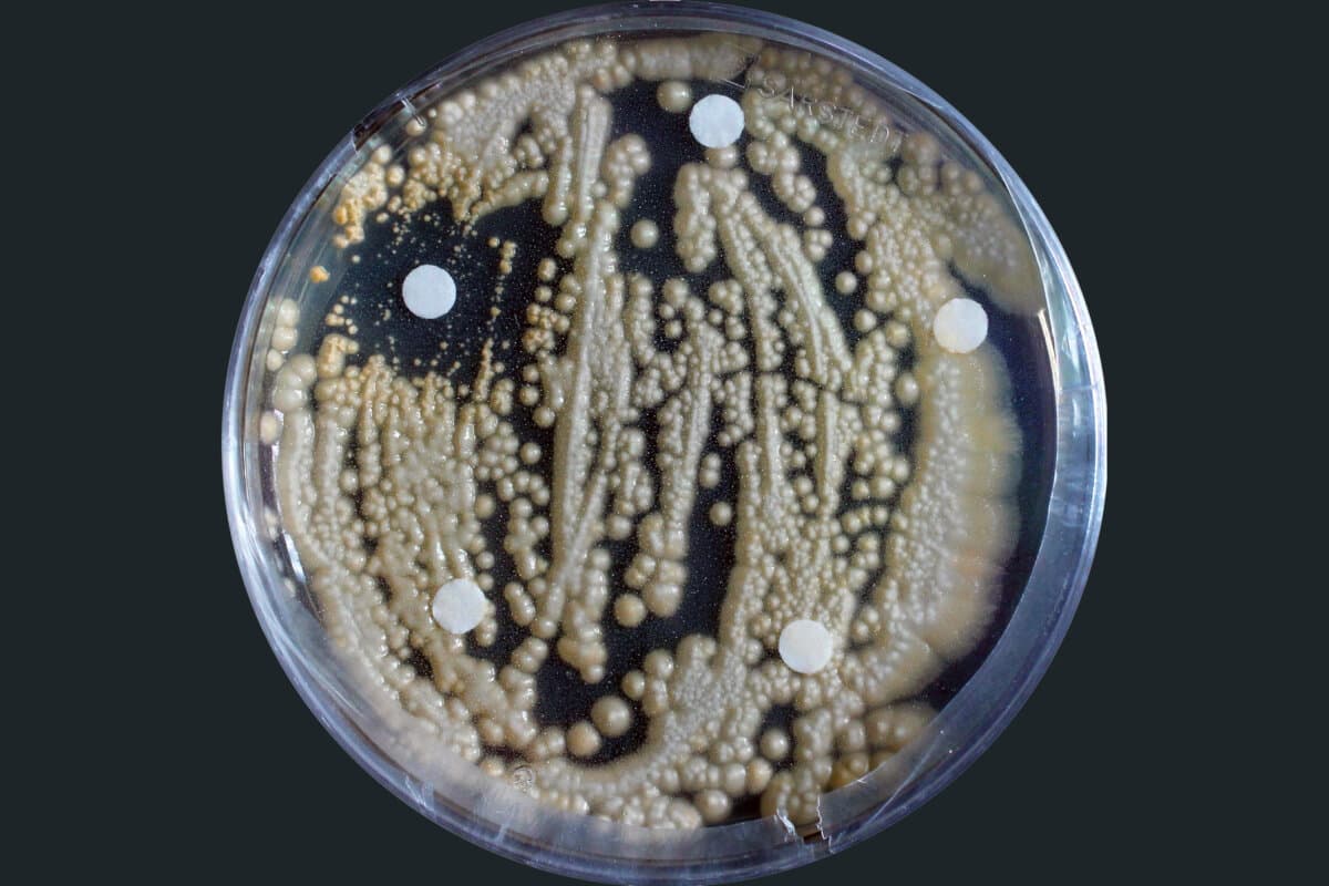 Der bodenlebende Pilz Apiotrichum porosum ist ein Beispiel für eine Art mit hohem pathogenen Potenzial, die sich in naher Zukunft zu einem menschlichen Krankheitserreger entwickeln könnte.
