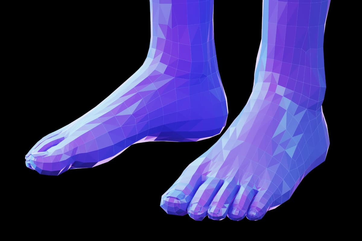 Fallbericht akrales Melanom