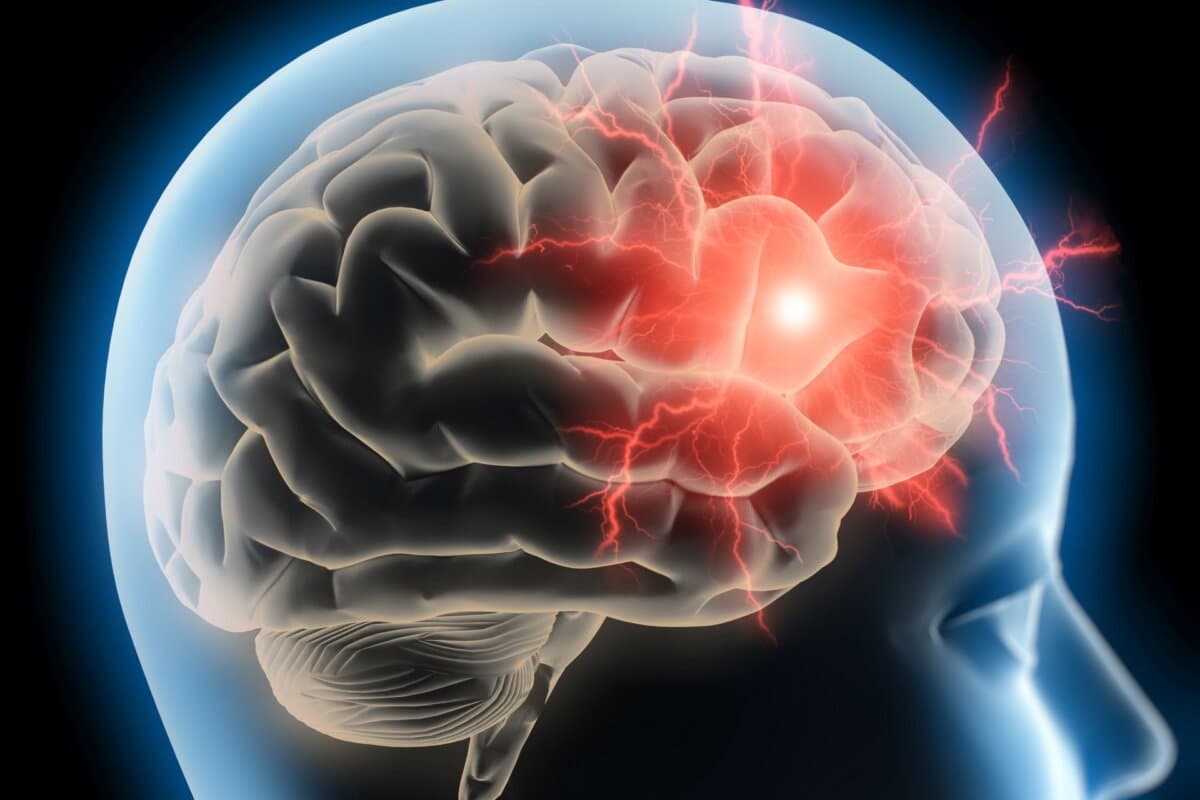 Kopfschmerz - Migräne