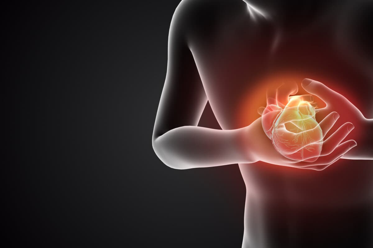 ONCO-ACS-Score: Neuer Score soll individuelle Herzinfarkt-Therapie bei Krebs erleichtern