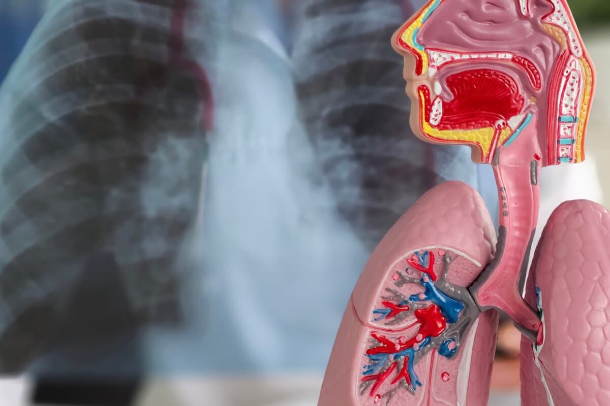 A doctor examines an X-ray of the lungs using a detailed anatomical model of the respiratory system