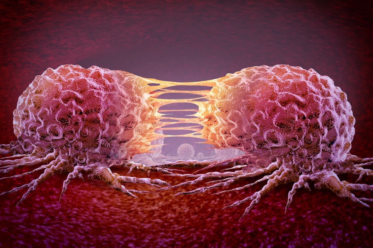 Metastasis Cancer cell and oncology or Malignant Cancerous Growth as growing dividing tumor cells and Malignancy disease