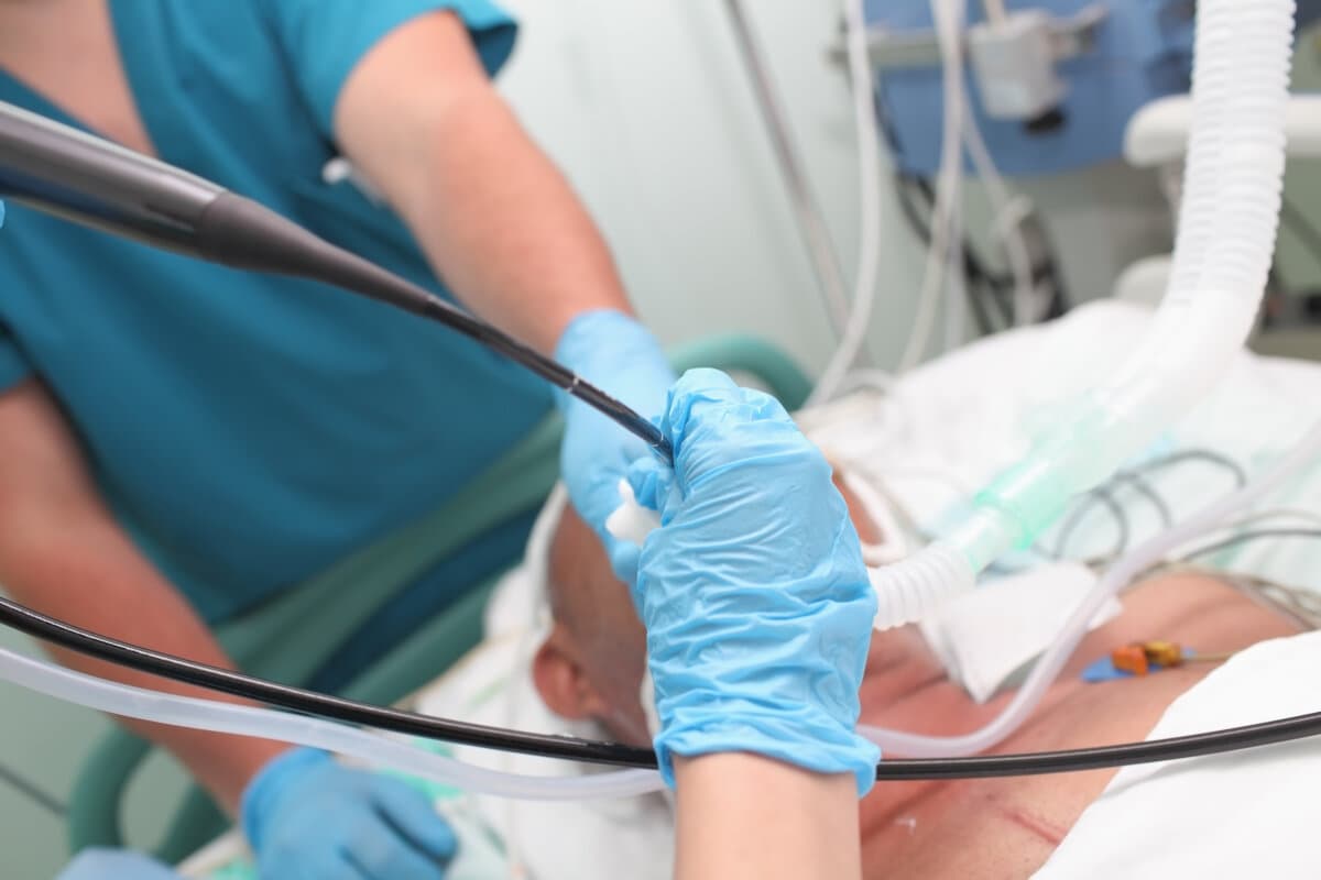 Bronchoscopy process in patients with severe lung disease who performed a group of doctors at the hospital.