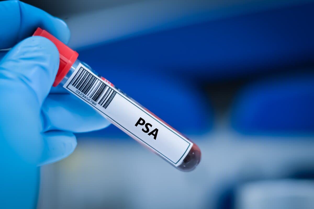 PSA-Screening