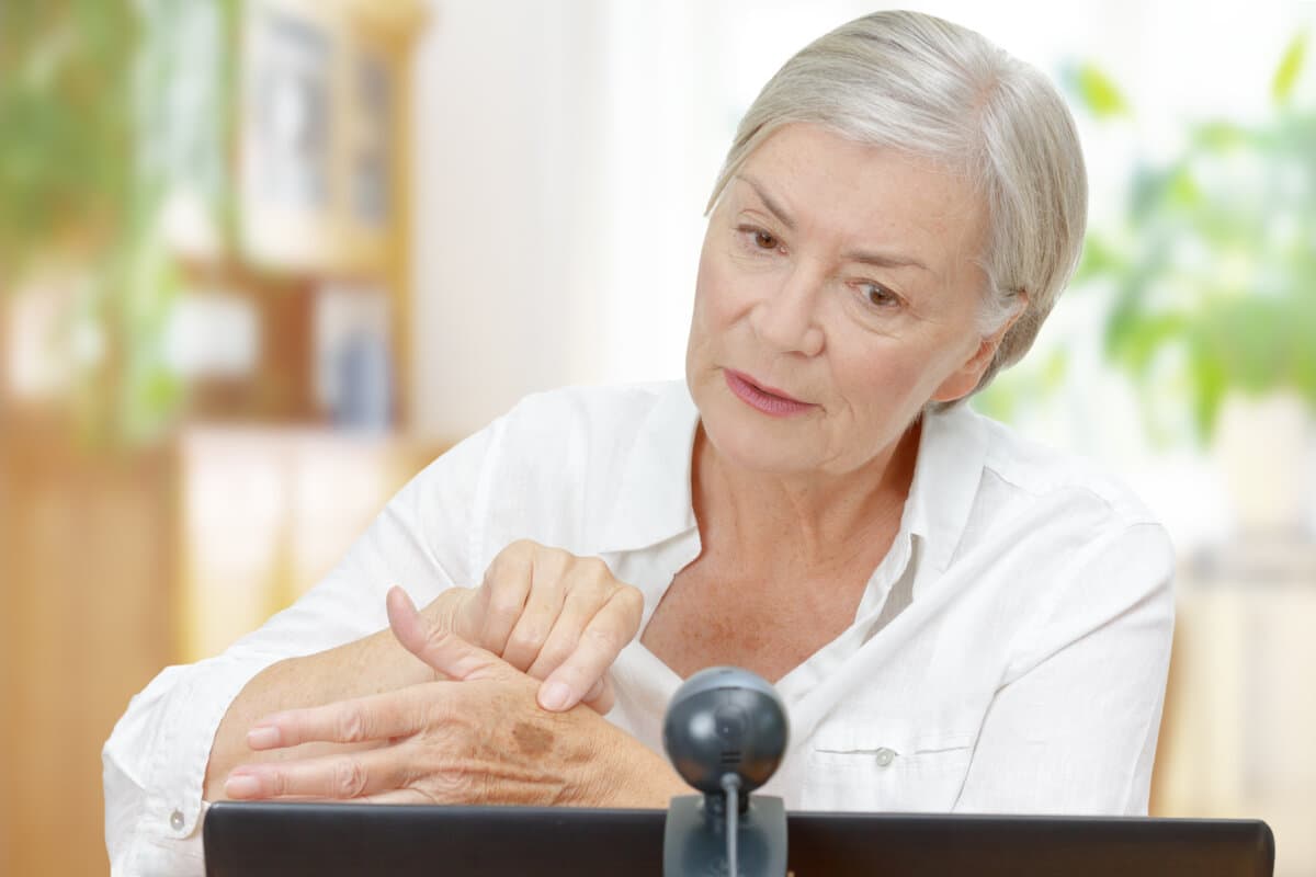 senior woman computer webcam mole