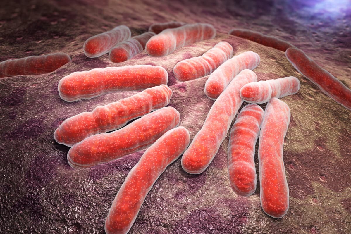 Bacterial infection tuberculosis