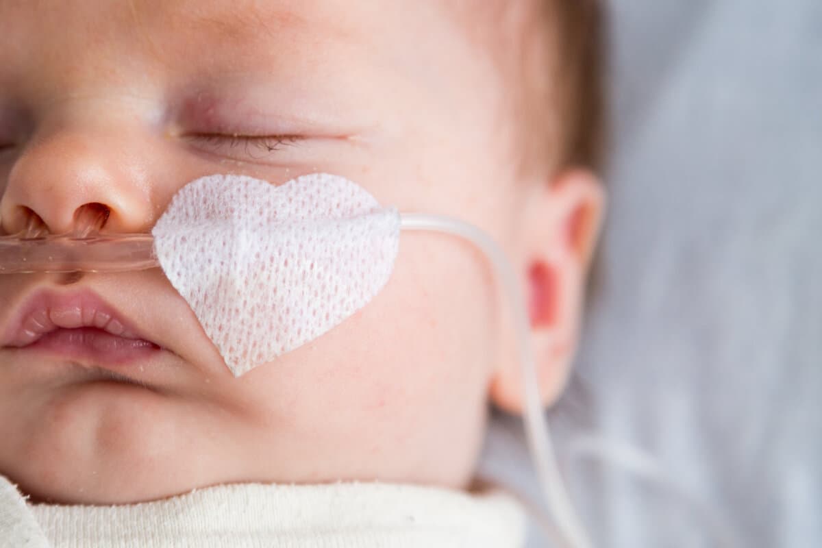 Bronchiolitis