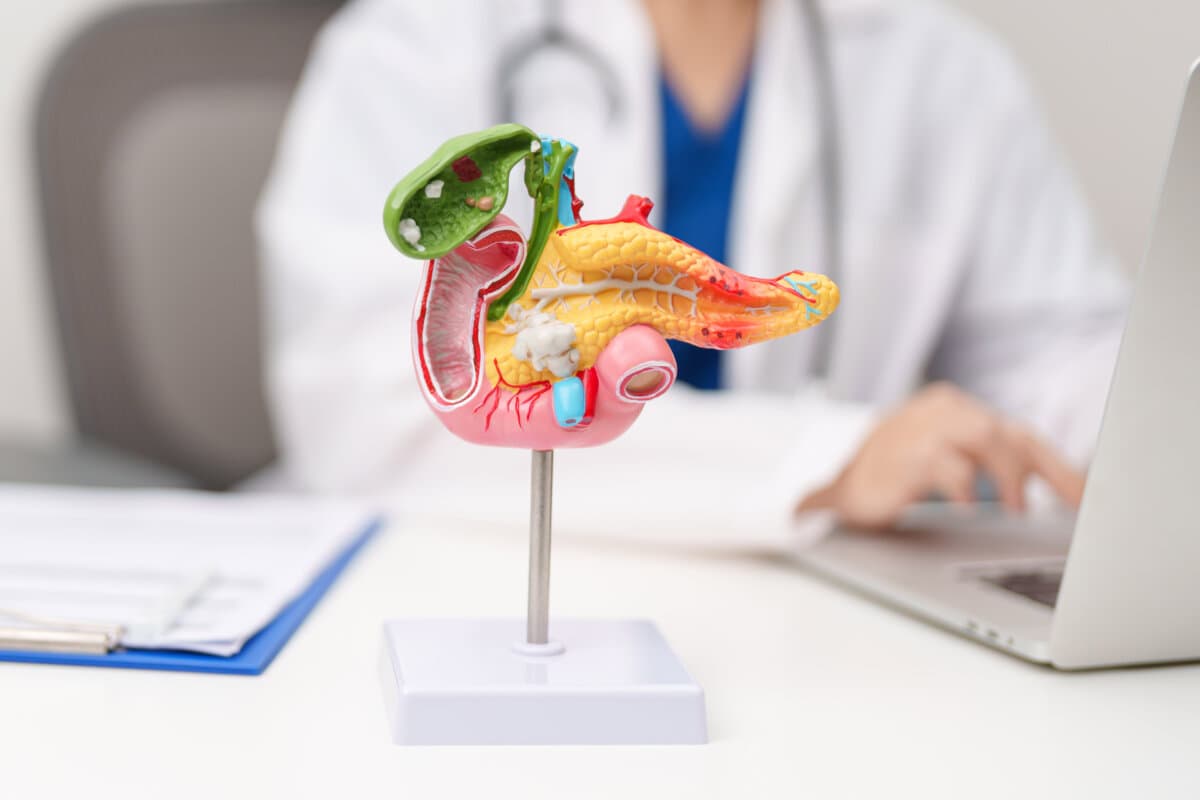 Doctor with human Pancreatitis anatomy model with Pancreas, Gall