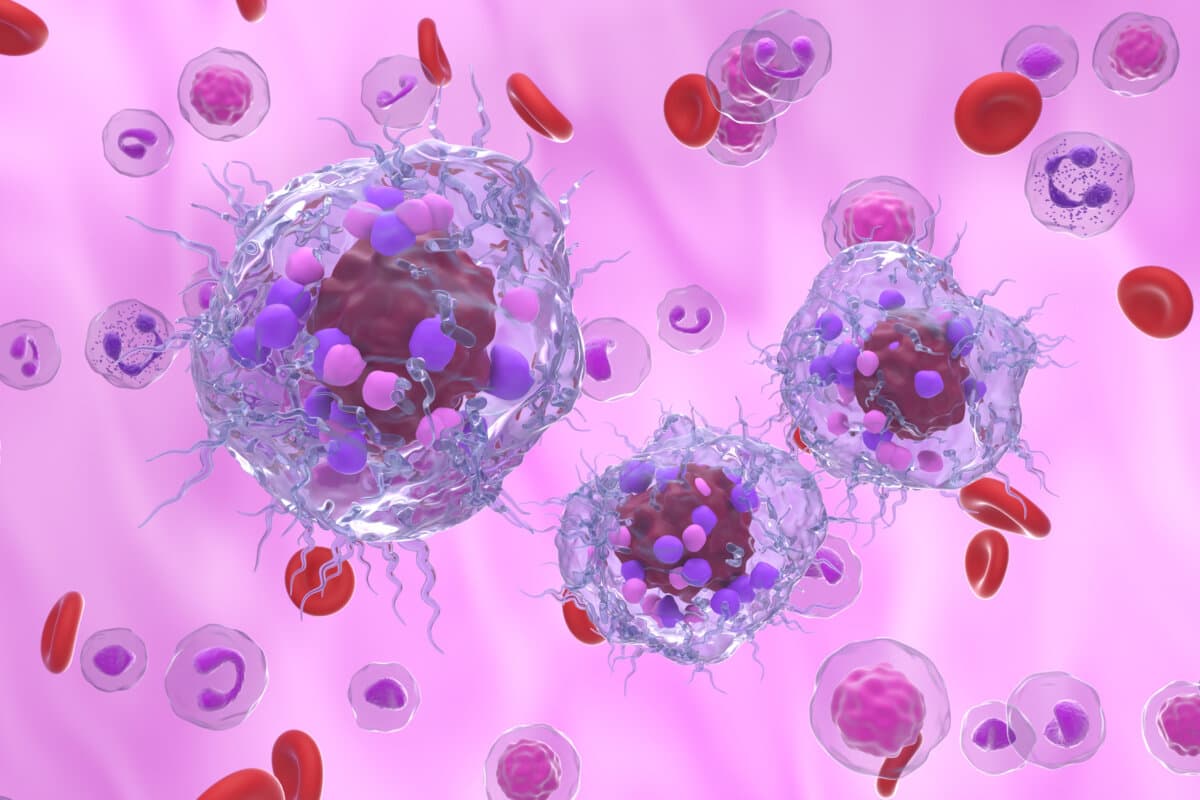 Neuroendokrine Tumoren (NET)
