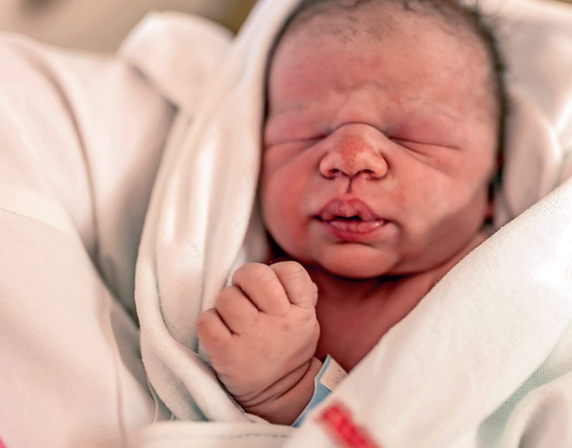 Kurz nach der Geburt soll das Baby Nahrung bekommen.