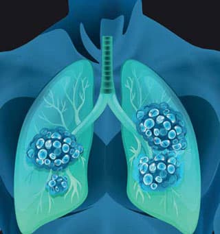 Foto: blueringmedia/iStock/Thinkstock