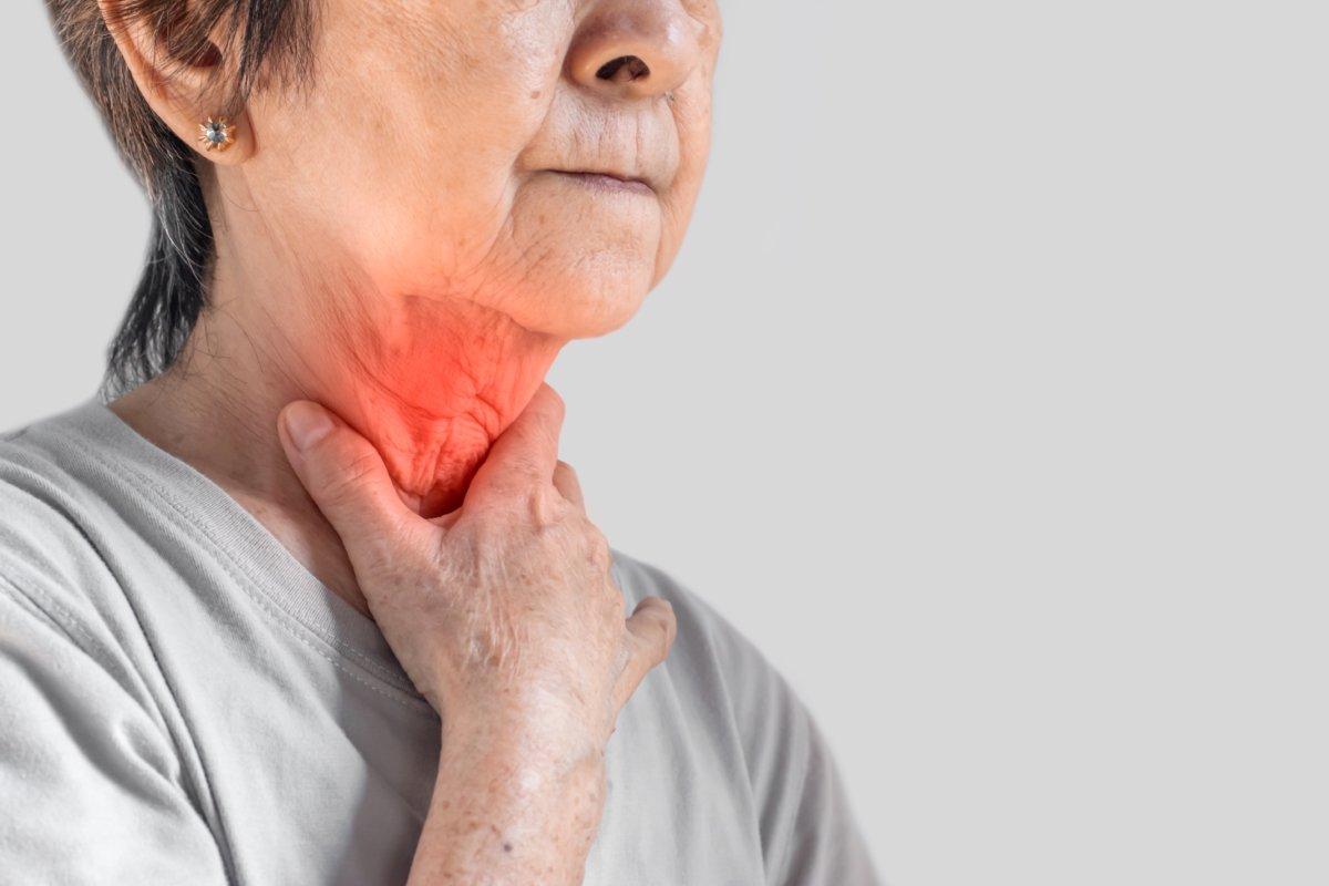 Redness at neck of Asian woman. Concept of sore throat, pharyngitis, laryngitis, thyroiditis, or dysphagia.
