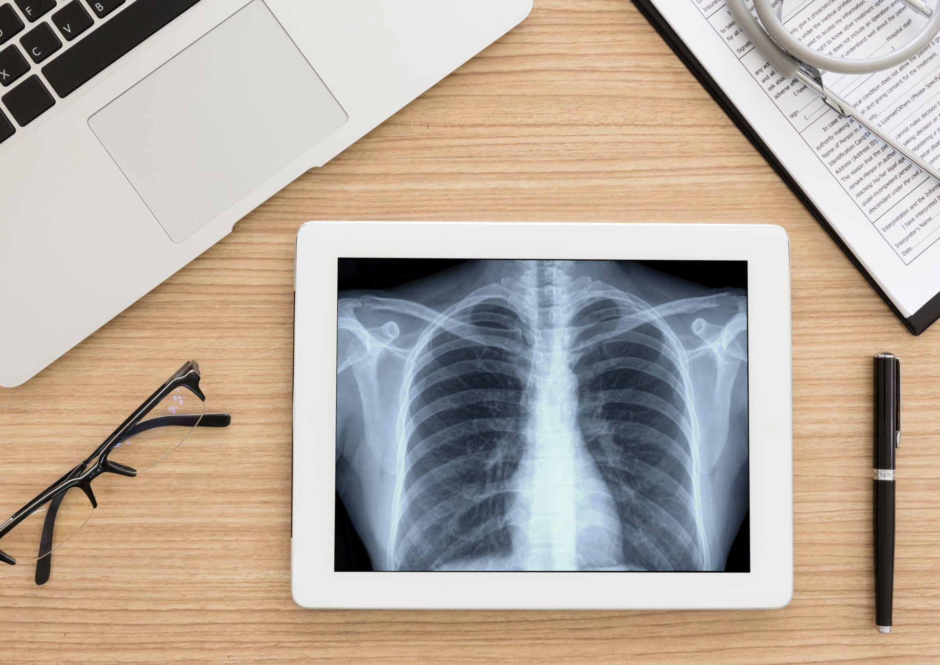 Gesundheitswesen und medizinisches Konzept. Lungenröntgenbild des Scan-Brustpatienten auf digitalem Tablettbildschirm. Draufsicht.