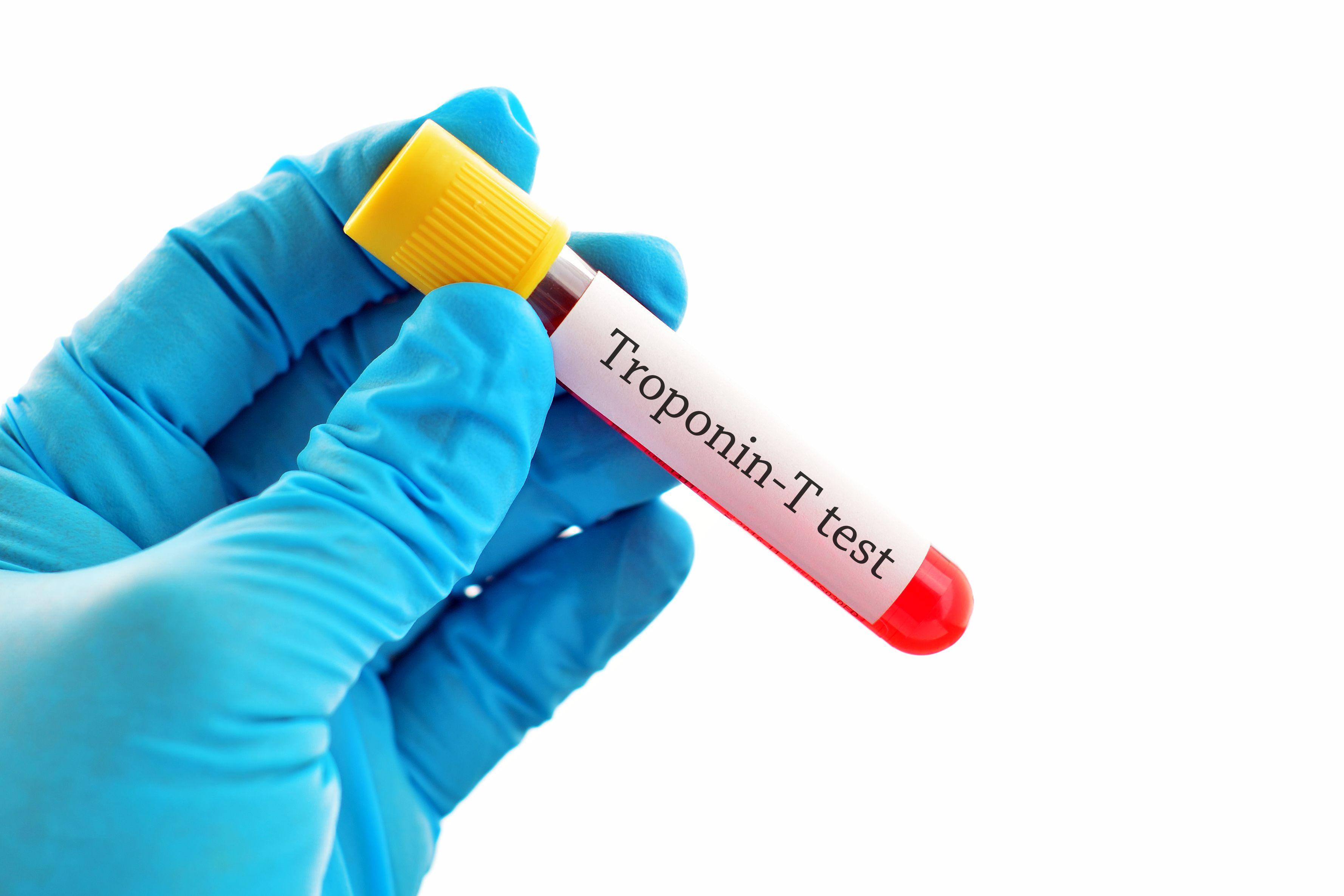 Blutprobe für Troponin-T-Test, Herzmarkertest
