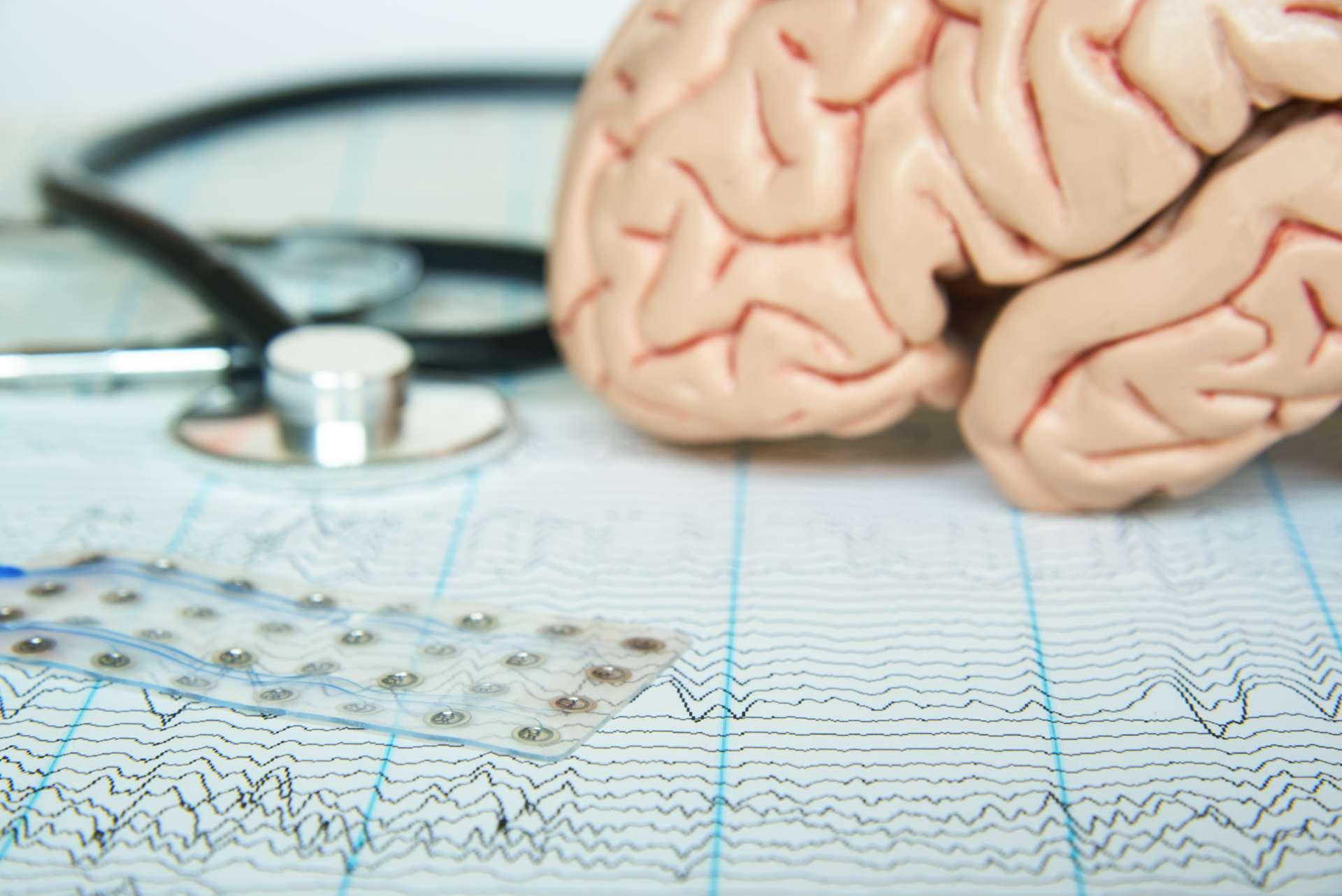 Subdurales Elektrodengitter auf Elektroenzephalographiepapier. Modell des menschlichen Gehirns und ein schwarzes Stethoskop im Hintergrund.